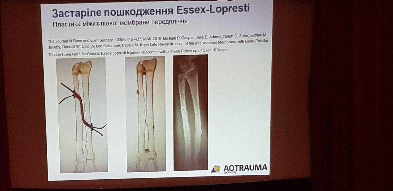 travmyi-loktevogo-sustava-aotrauma-seminar-4